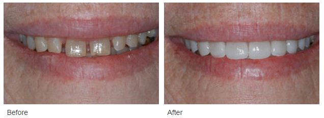 Glendora Cosmetic Dentist