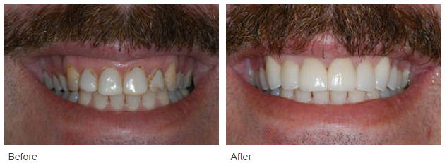 Glendora Cosmetic Dentist