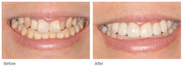 Glendora Cosmetic Dentist